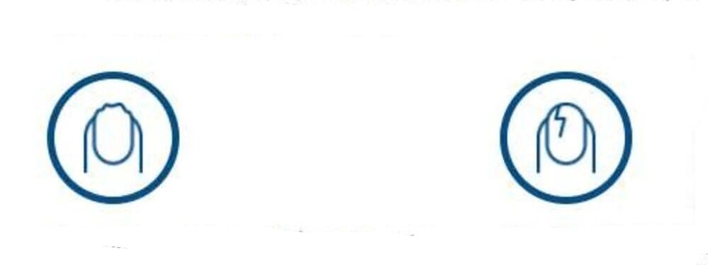 deformácia nechtov v dôsledku plesňovej infekcie